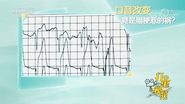 突然间改变方言和脑梗有关?专家:构音语言中枢受到损害