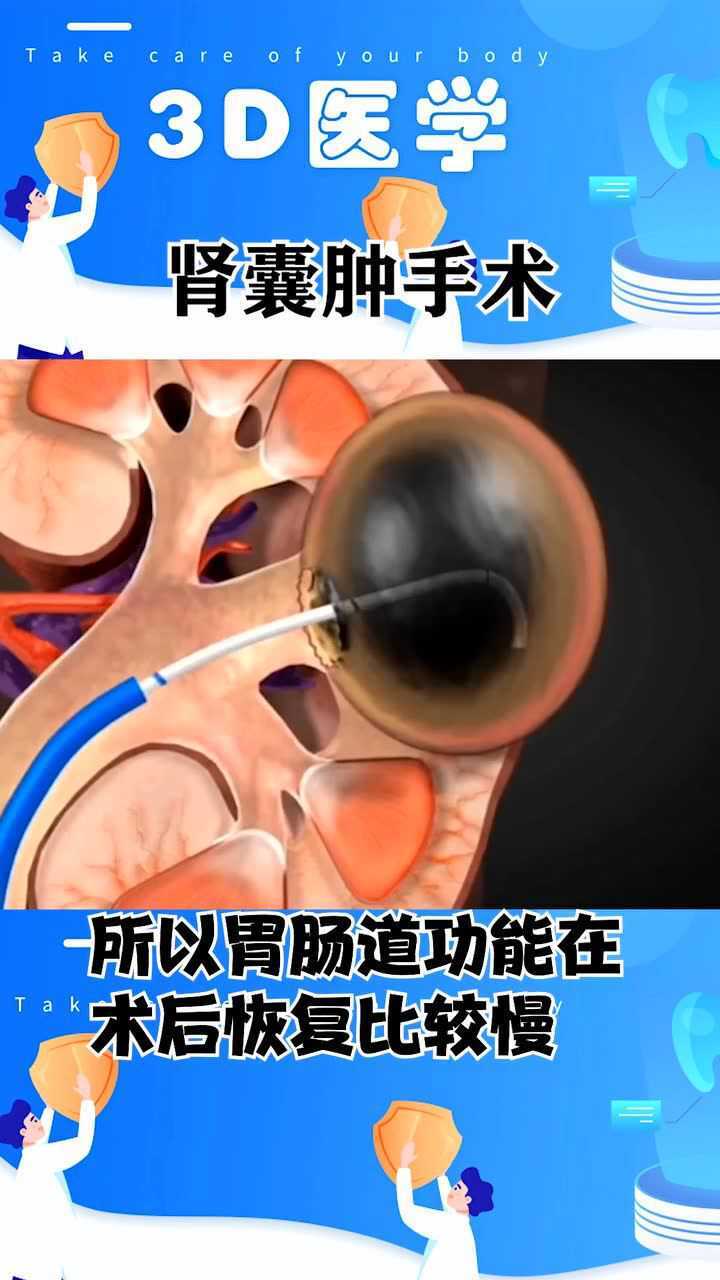 3d医学肾囊肿手术看得我肾疼