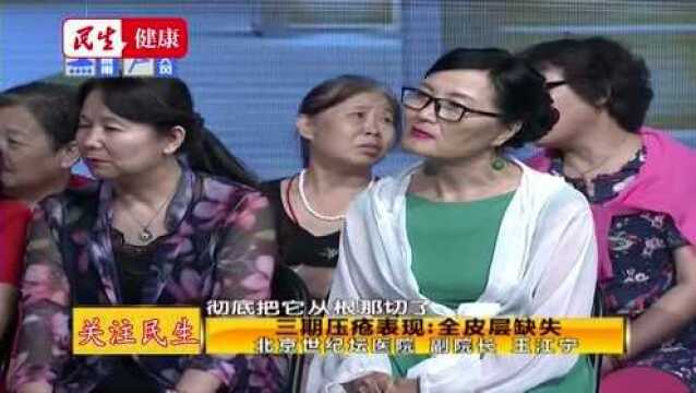 压疮出现这些症状,那就该注意了,小心危及生命