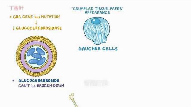 戈谢病原因,症状,诊断,治疗,病理