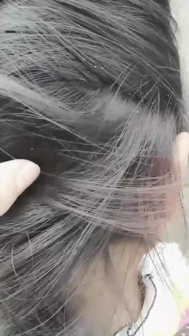 虱子卵 腾讯网