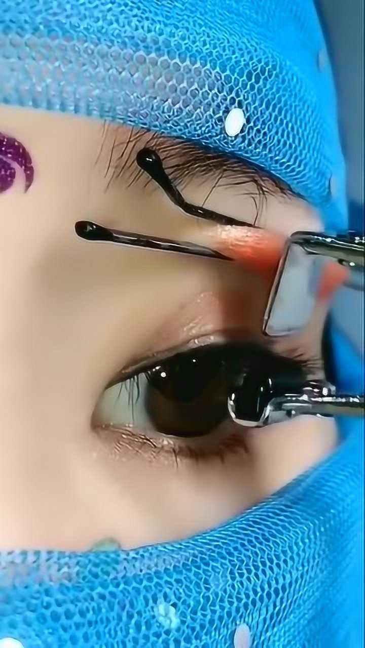 拔睫毛都是这样弄的吗,有点疼