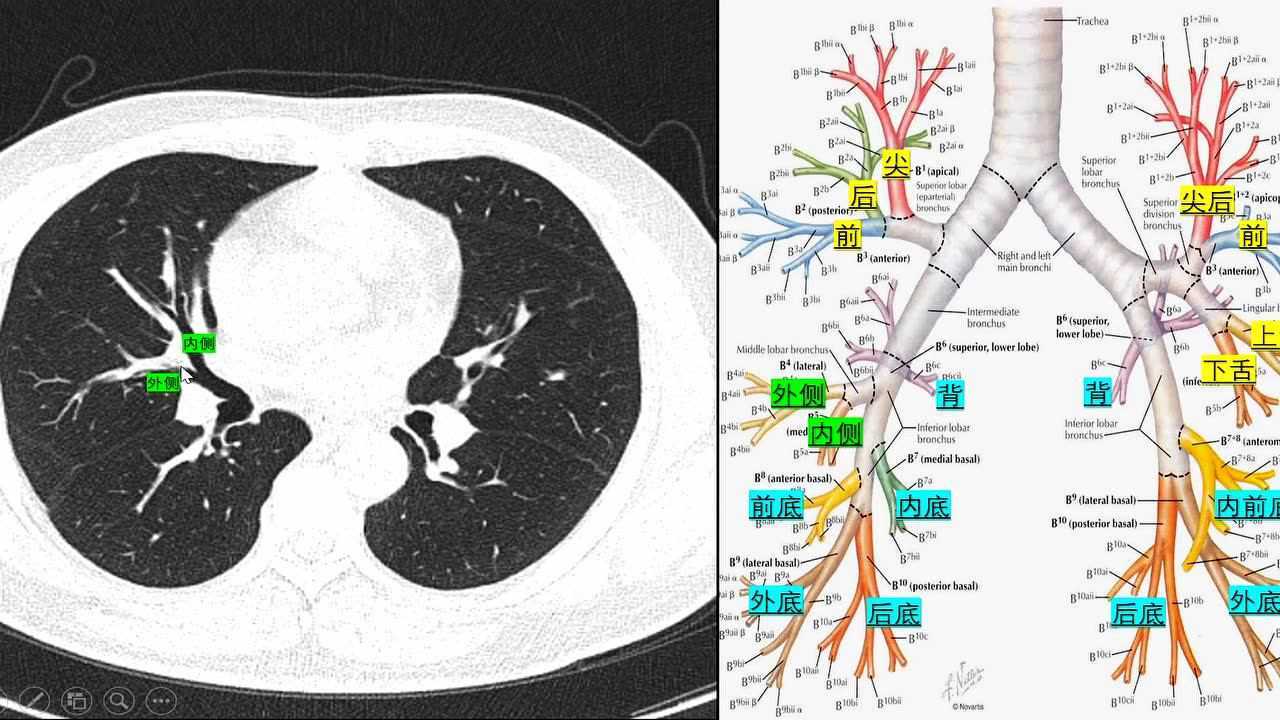 右肺中叶分段示意图图片