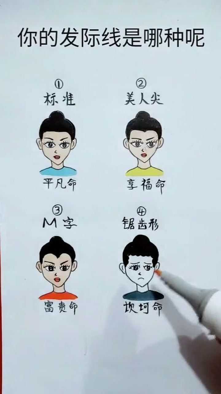 你的发际线是这几种吗