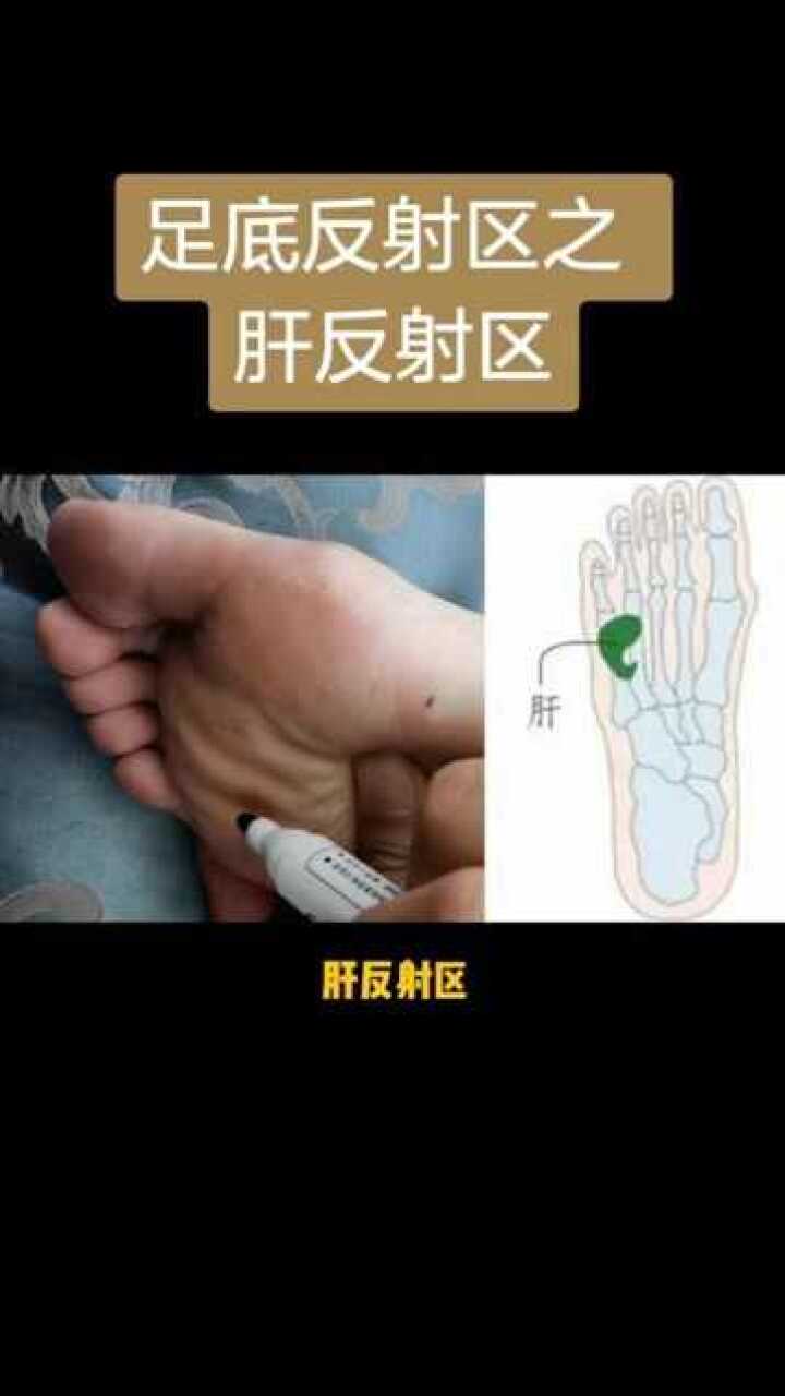 足底反射区之肝反射区足底反射疗法建议收藏