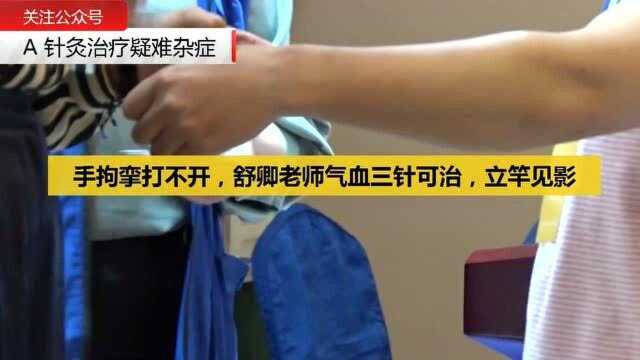 27手拘挛打不开,舒卿老师气血三针可治,立竿见影