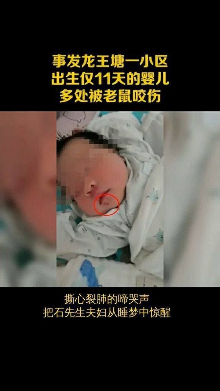 事发龙王塘一小区,出生仅11天的婴儿,多处被老鼠咬伤