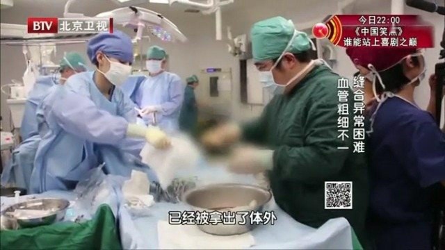 生命缘:生命接力5:铜铜的肝脏被拿出体外,医生要将它安装到贤宝体内!