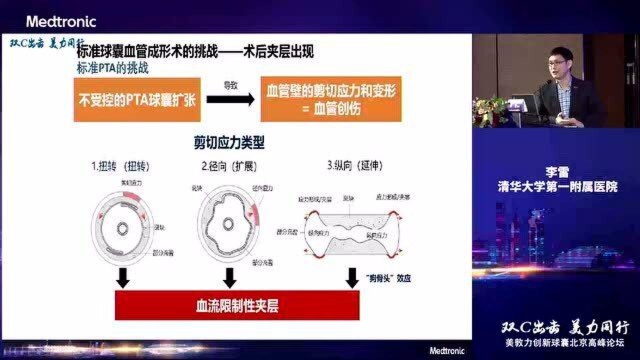 李雷教授《新型均压限制性球囊Chocolate设计原理及临床研究数据》