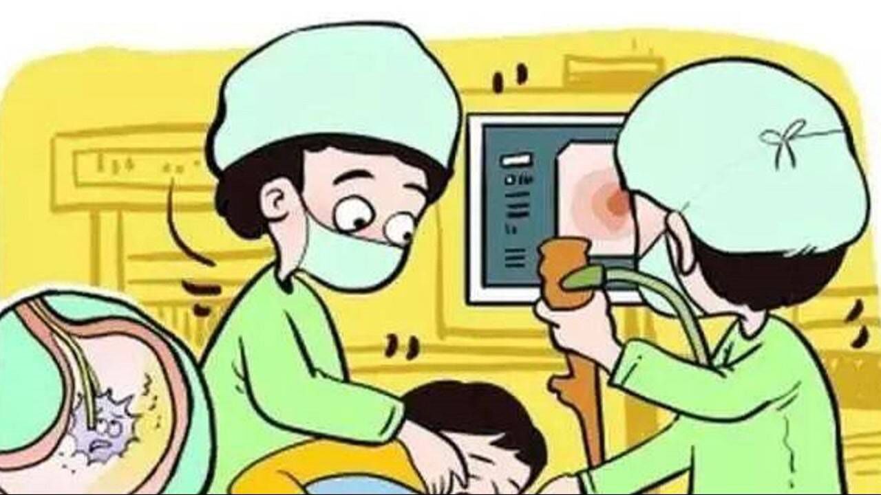 无痛胃肠镜检查宣教_高清