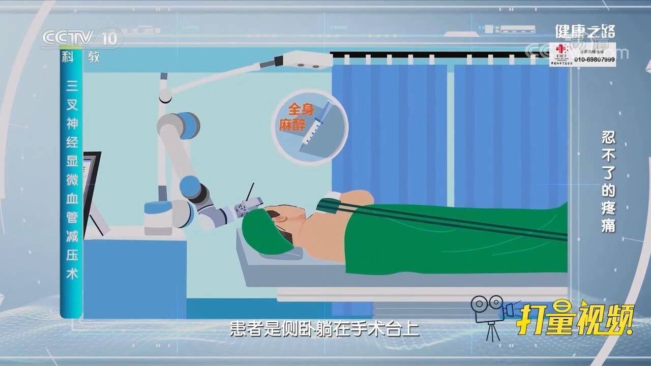 三叉神经显微血管减压术是如何进行的？动画清晰演示_高清
