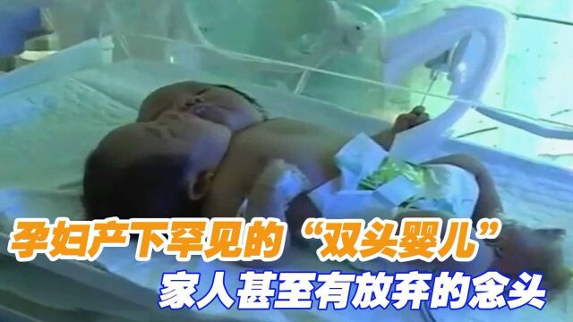 孕妇产下罕见的“双头婴儿”,家人甚至有放弃的念头,太让人心疼