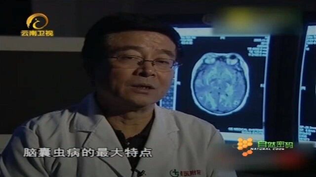 医生解读脑囊虫病,一起来看看吧!