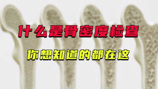 什么是骨密度检查,该怎么查?关于骨质疏松,医生告知实用细节