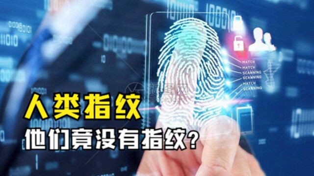 指纹也是“身份证”,为何有人天生没有?他能逃脱法律制裁吗?