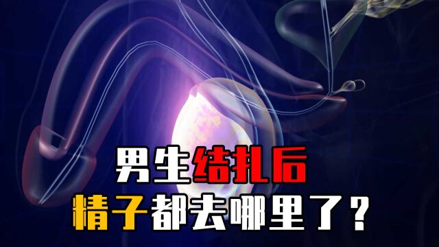 胯下一凉,男生结扎究竟结哪里?看完这个视频你就知道了