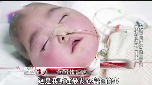 3岁幼童脑死亡昏迷400天,凶手竟是母亲的情人