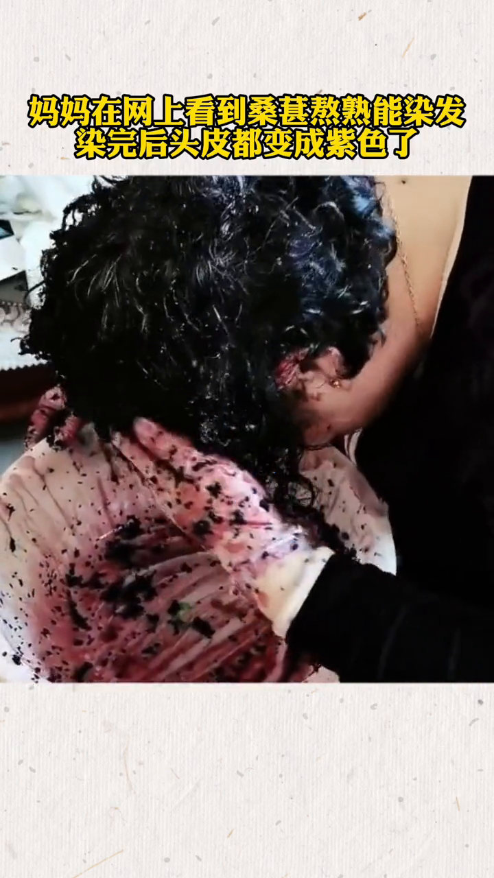 妈妈在网上看到桑葚熬熟能染发 染完后头皮都变成紫色了