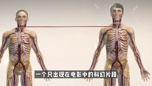 [图]18个小时花费7000万，世界首例换头手术成功？人类也能实现换头吗