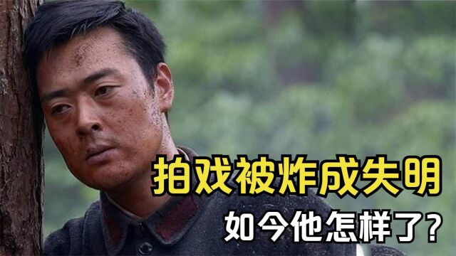 张桐:32岁因拍戏双目失明,抑郁后被女友照料6年,如今怎样了?