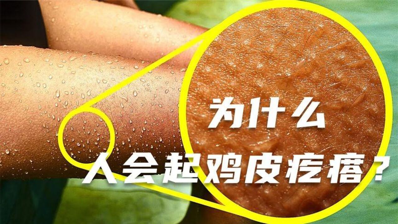 男生为什么会起鸡皮疙瘩(男生说起鸡皮疙瘩是不是讨厌)