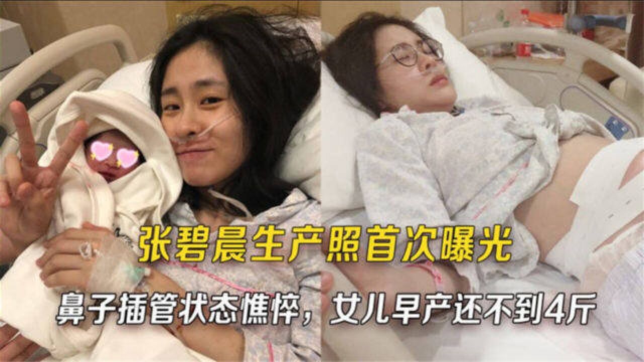 張碧晨孕照首次曝光,鼻子插管狀態憔悴,女兒早產還不到4斤