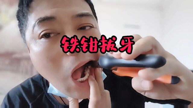 老虎钳子拔牙