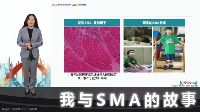 关注患儿成长,守护祖国未来 | 我与SMA的故事 ⷠ第5期