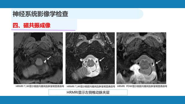 神经系统疾病的辅助检查(1)