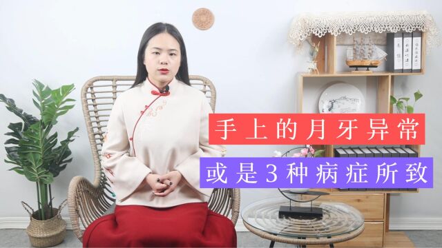 指甲上的月牙是什么?其结构异常和什么有关?这3点不妨一看