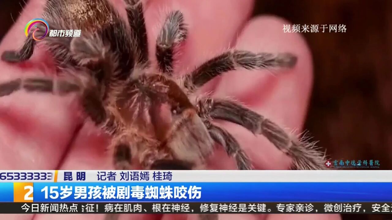 世界第一毒蜘蛛 咬人图片