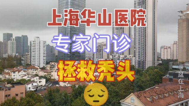 上海华山医院治疗秃头脱发|告别地中海荷包蛋|女性脱发