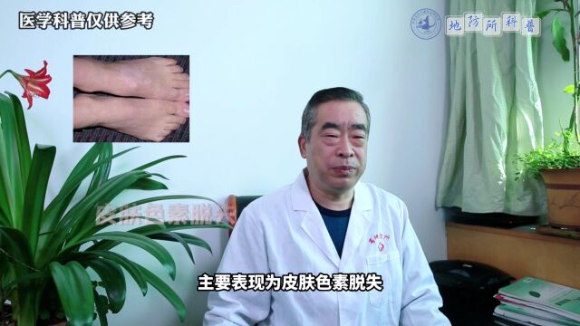 地方性砷中毒是一种生物地球化学性疾病,对于如何预防你真的了解吗?(一)