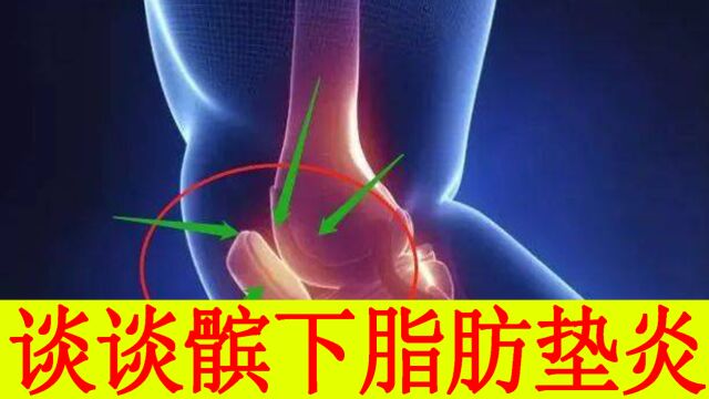 膝关节髌下脂肪垫炎如何诊断,如何治疗?