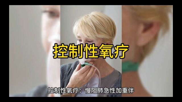 控制性氧疗:慢阻肺急性加重伴呼吸衰竭患者的治疗关键选择