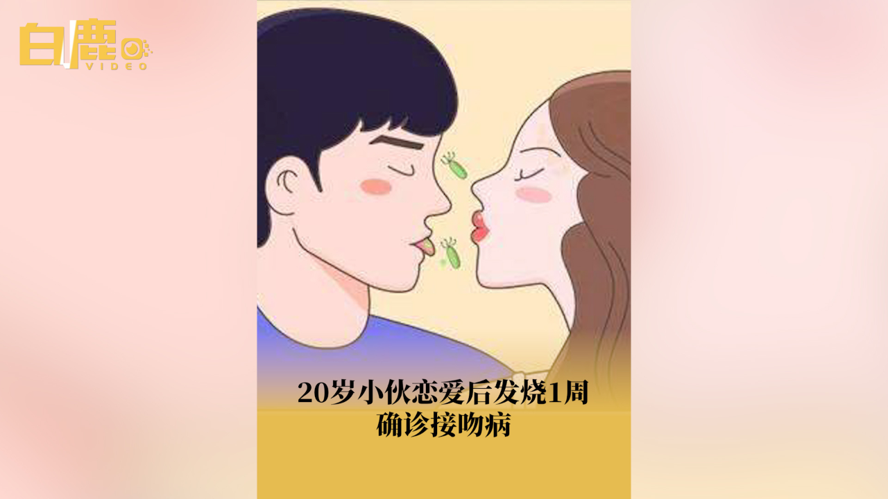 20岁小伙恋爱后发烧1周确诊接吻病