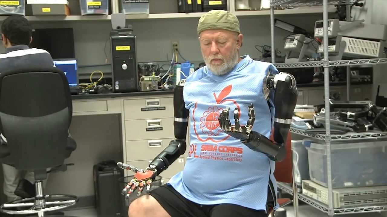 国外研发机械假肢装上如同真手臂残疾人的福音