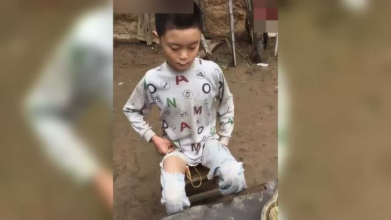 被母亲抛弃的孩子天天还要插着尿管过生活看的落泪