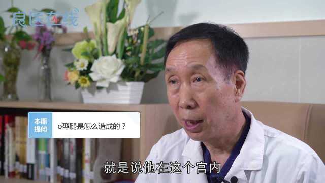 O型腿是怎么造成的