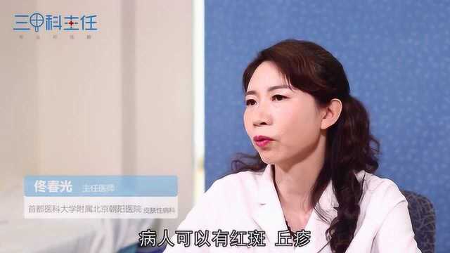 湿疹和红斑狼疮有什么区别