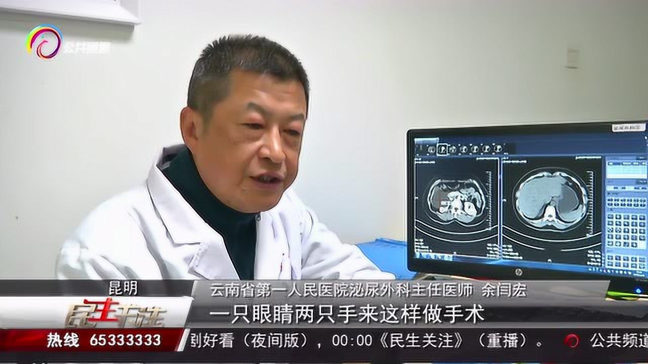“无疤痕”去除肾囊肿手术，在云南可以做了，广大爱美人士的福音_高清