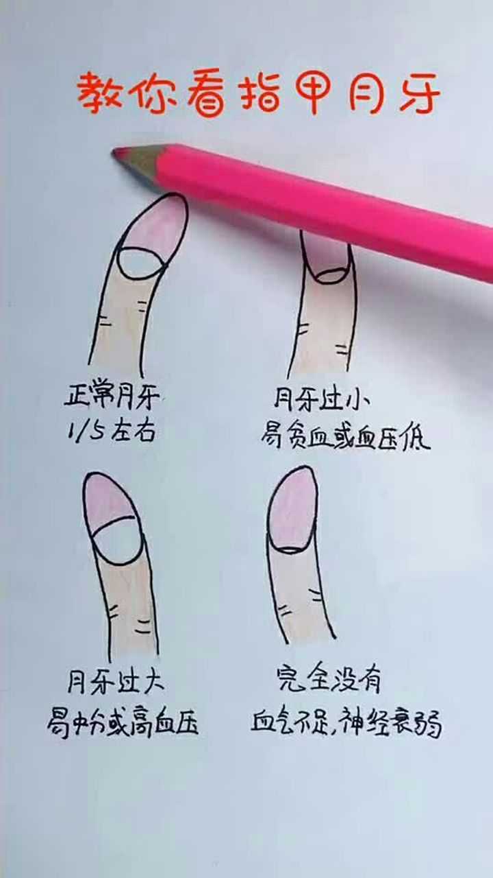 教你看指甲月牙,你的月牙什么样