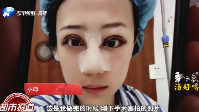 本想变美丽 如今吓坏人!郑州魔镜整形:我们看过 没问题