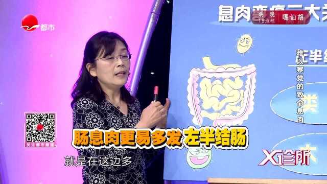 直肠肛门都在左半结肠?专家解释,这里更容易长息肉!