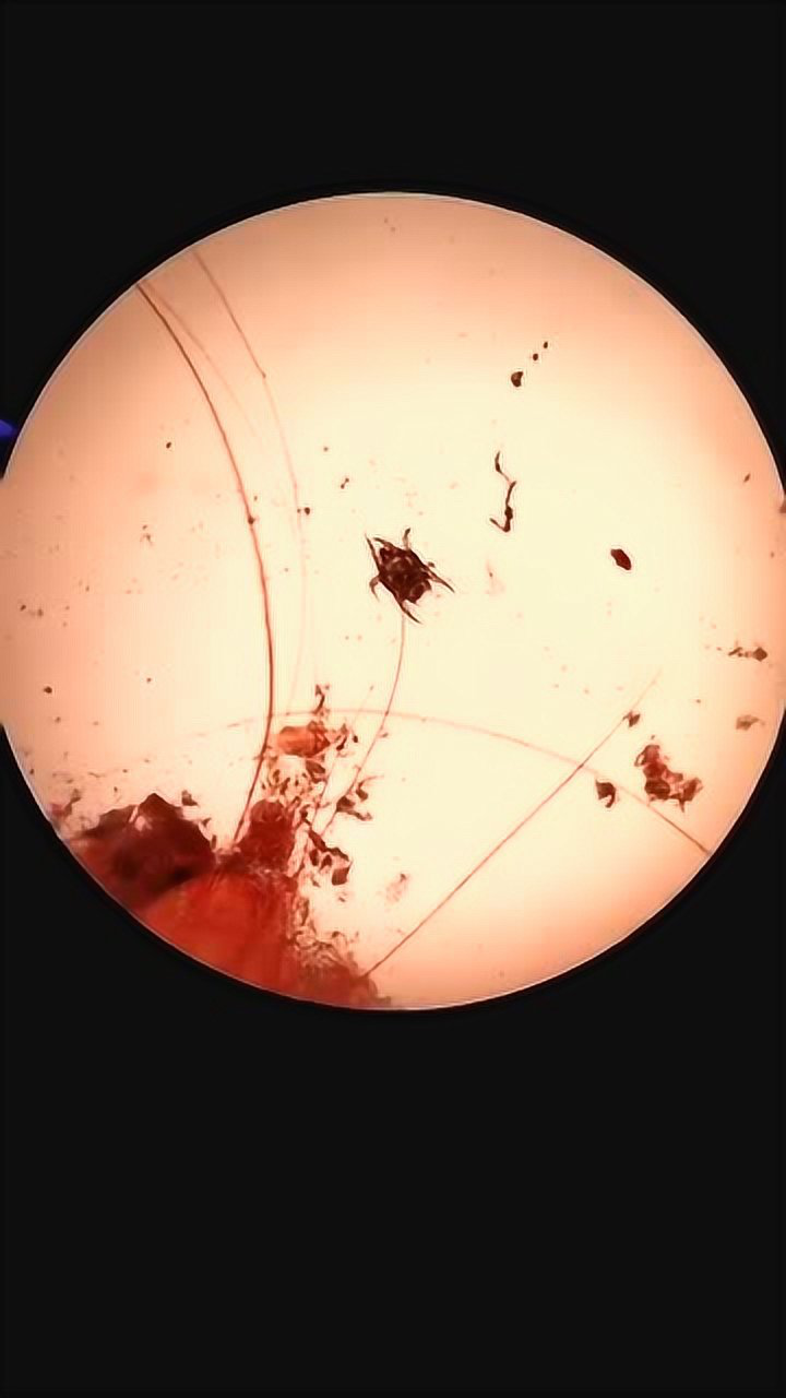 猫耳朵里的耳螨这是显微镜下看的寄生虫你现在看一只一会就成千上万