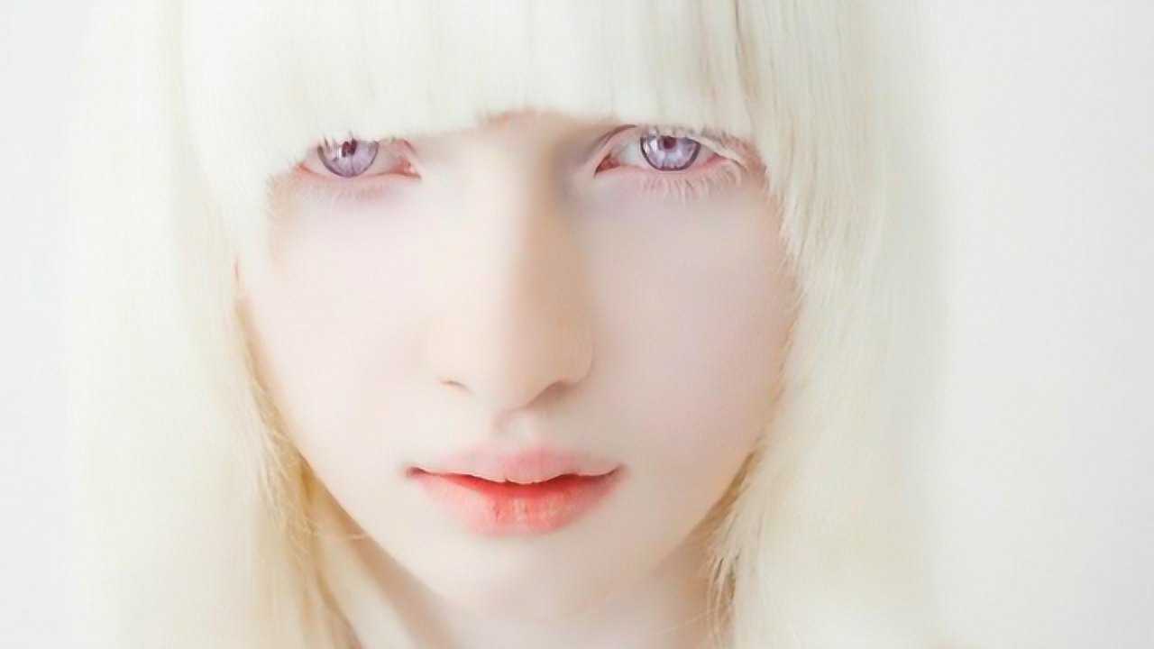 世界最漂亮的白化病女孩整个人像一堆白雪还成为了著名模特