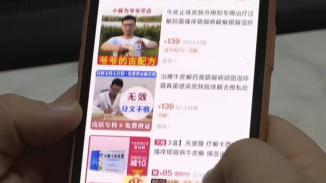 男子网购“苗药”治牛皮癣惨变“蛇人”,差点没命