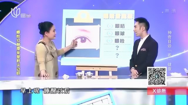 眼眼睛红肿是肝火旺?提醒:若伴有这几个症状,小心是心脏病