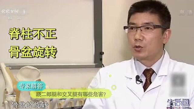 二郎腿、交叉腿危害知多少 看完视频我立马坐直了1