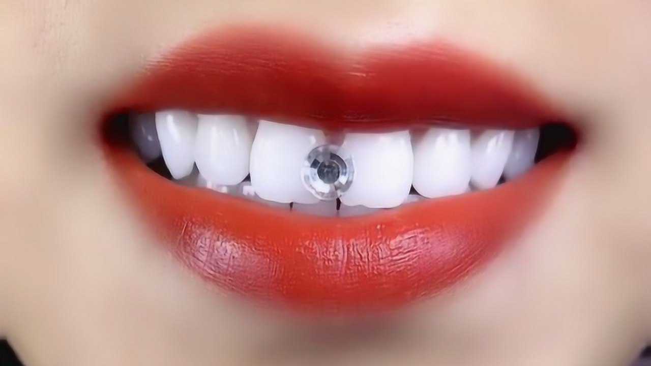 这姑娘可真有意思结婚不要钻戒非要镶牙钻